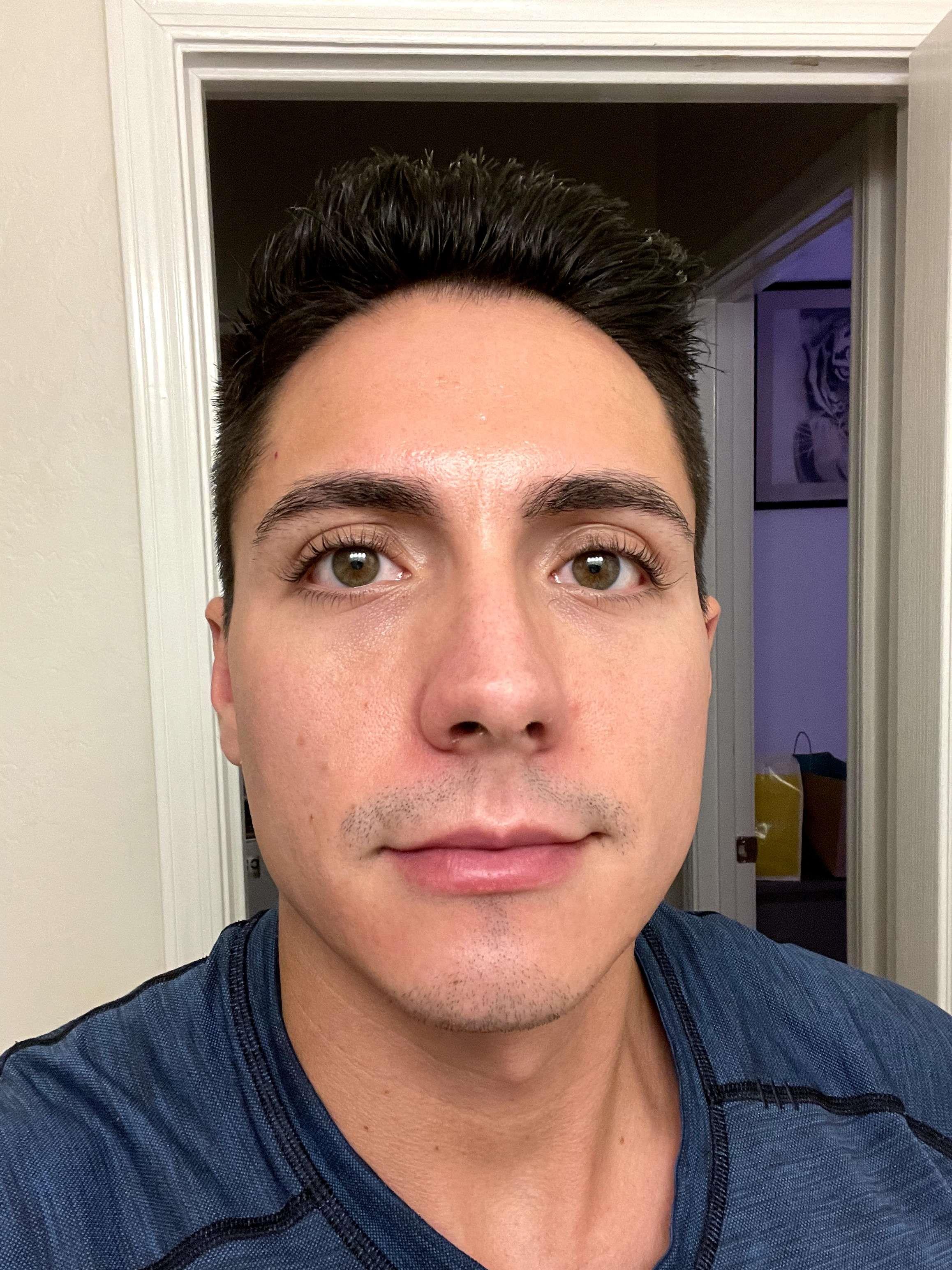Reviews of Pure Skin Medspa - Phoenix AZ | Vagaro